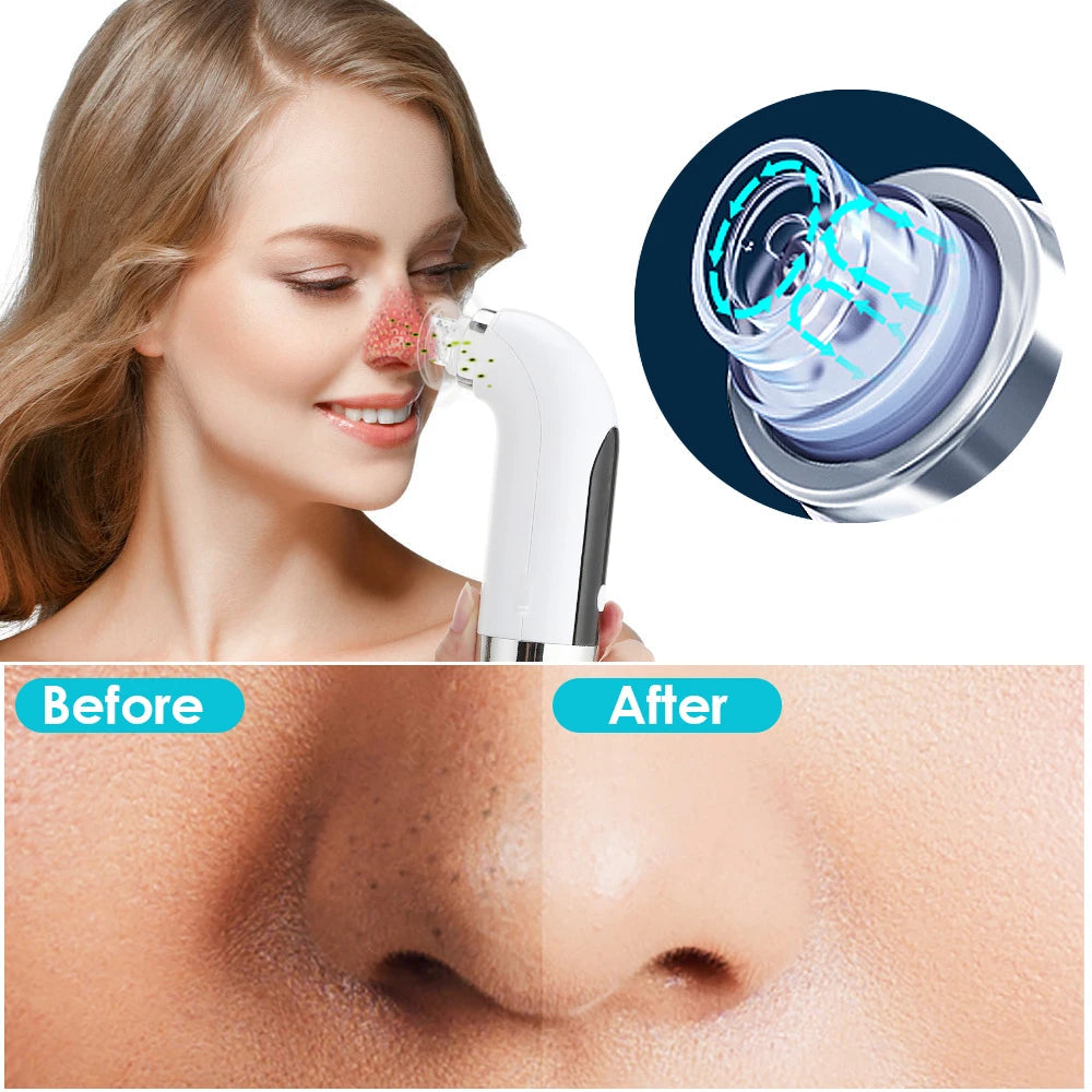 Electric Small Bubble Blackhead Remover USB Water Cycle Pore Acne Pimple Removal Vacuum Suction Facial Nose Cleaner Tool