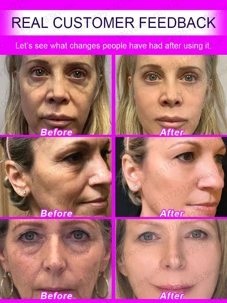 Anti Wrinkle Aging Instant Effect Remove Facial Wrinkles