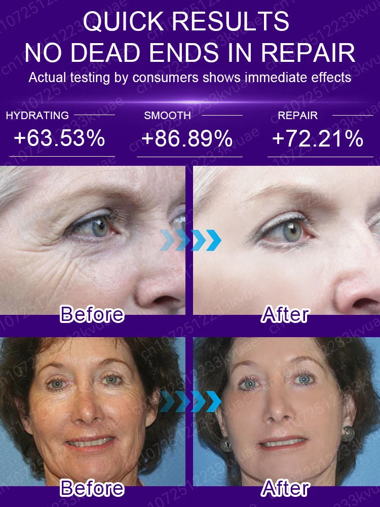 Anti Wrinkle Aging Instant Effect Remove Facial Wrinkles